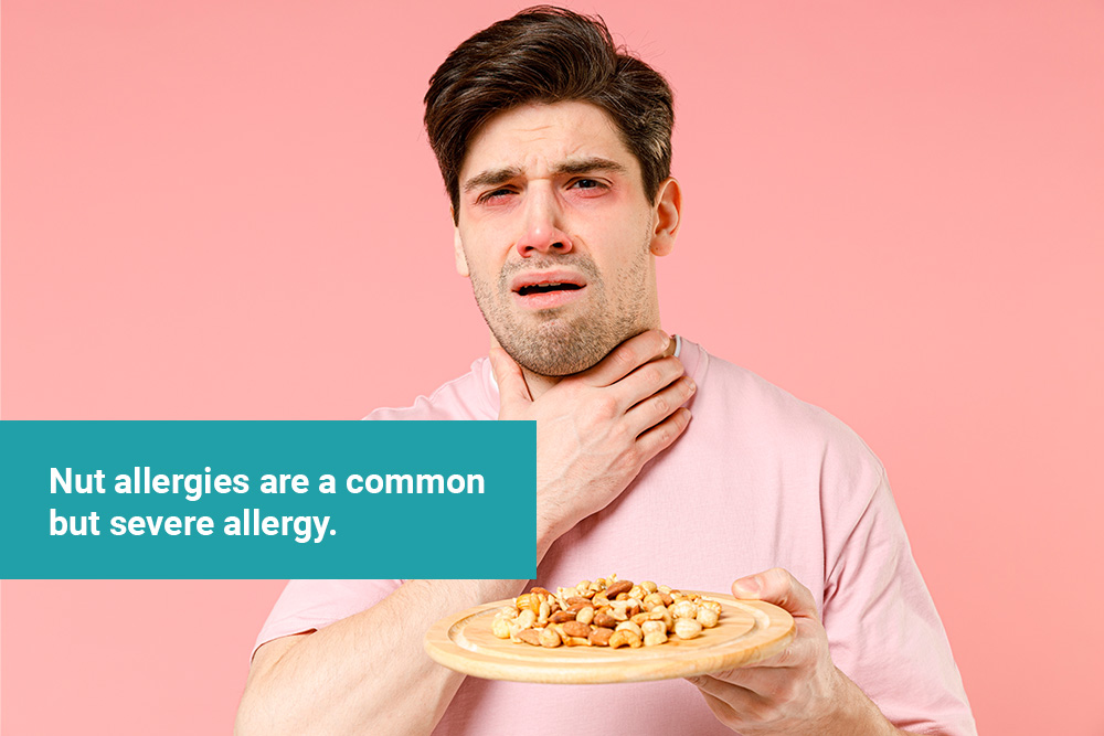 What You Need to Know About Nut Allergies 22 best allergists near me