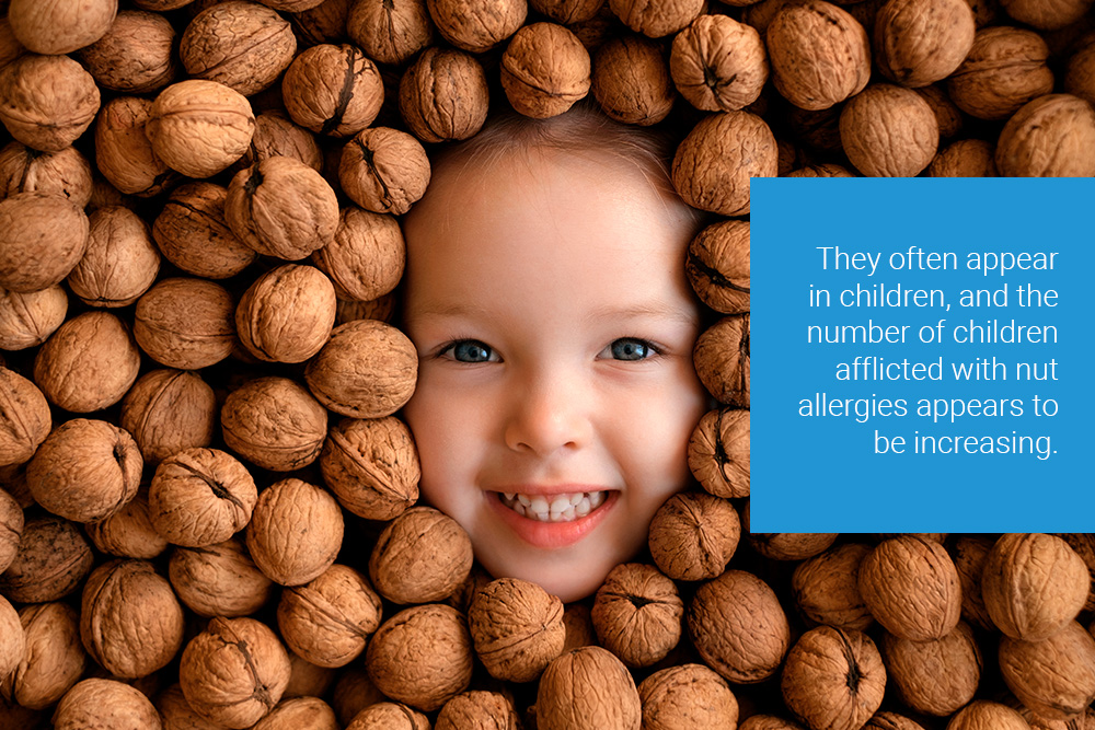 What You Need to Know About Nut Allergies 31 best allergists near me