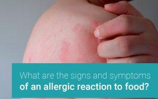 food allergy testing near me