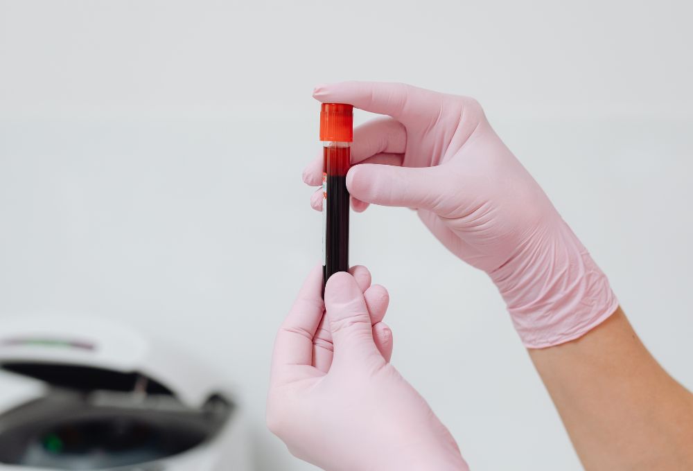 Allergy Testing for Athletes: Staying Active and Breathing Easier in the Desert Heat