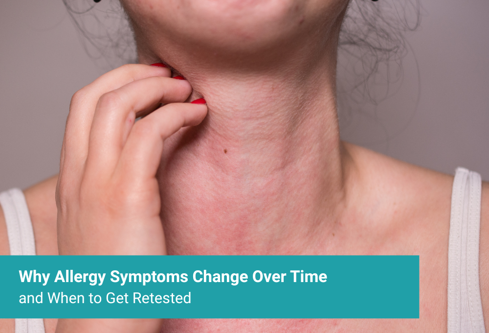 Why Allergy Symptoms Change Over Time and When to Get Retested