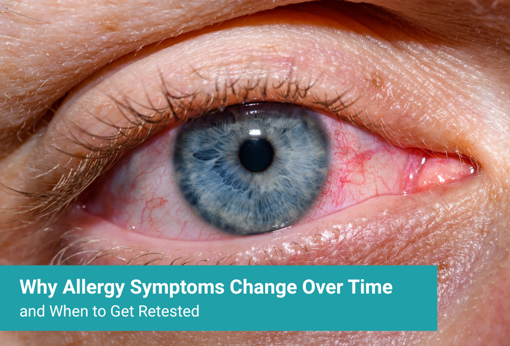 Why Allergy Symptoms Change Over Time and When to Get Retested