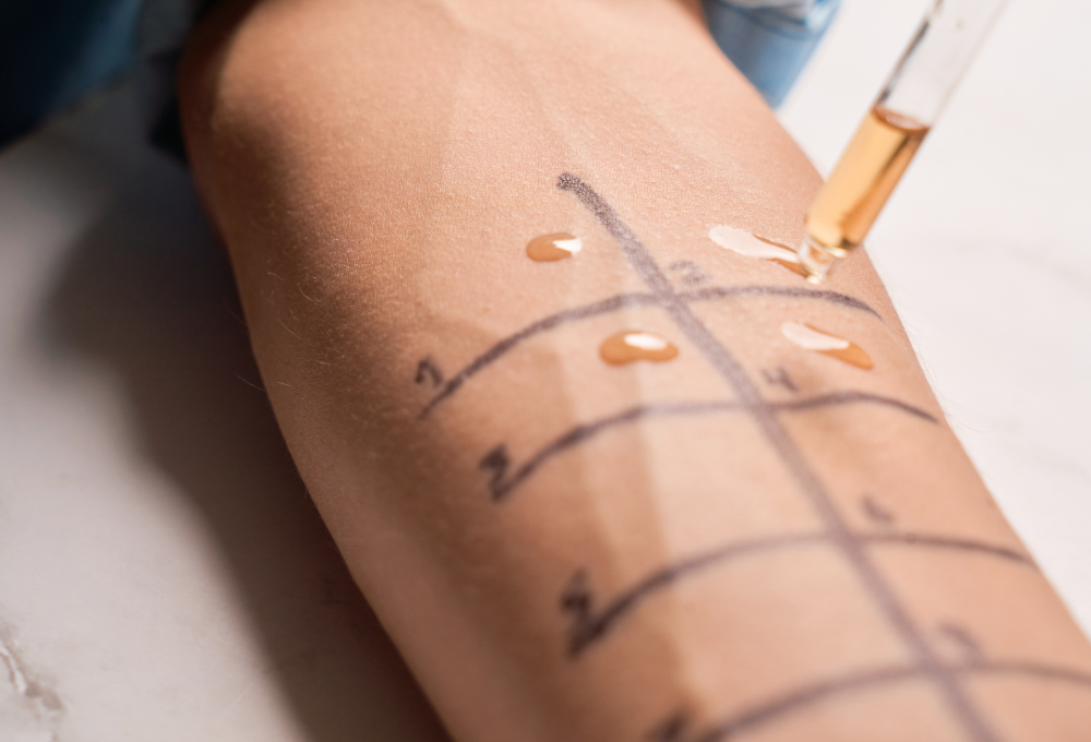 Environmental Allergy Testing in Las Vegas, NV