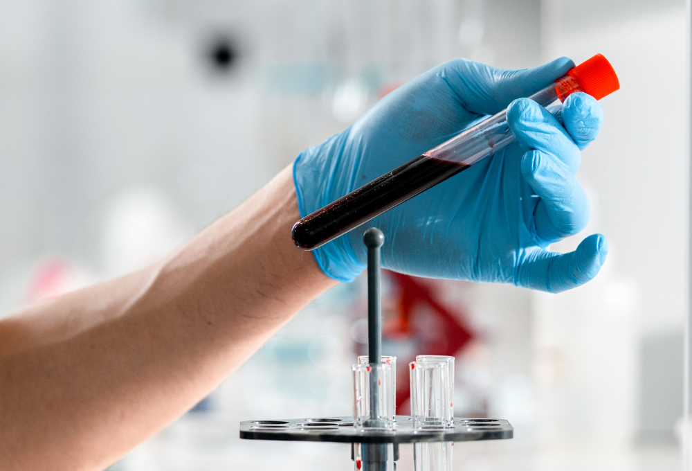 unnamed (1) Allergy Testing in North Las Vegas, NV