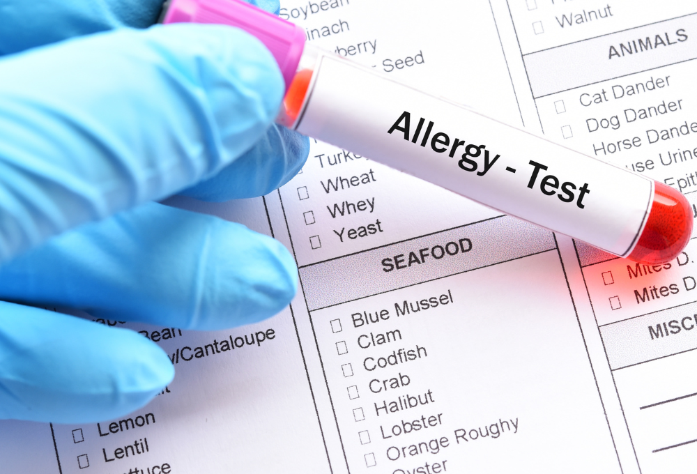 unnamed (2) Food Allergy Evaluation in North Las Vegas, NV