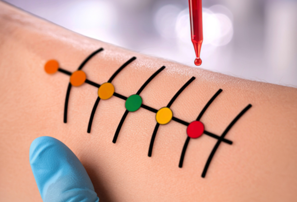 unnamed (2) Allergy Testing in North Las Vegas, NV