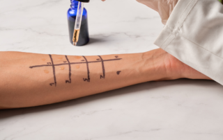 What Happens During an Allergy Test? A Step-by-Step Patient Guide