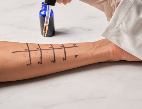 What Happens During an Allergy Test? A Step-by-Step Patient Guide