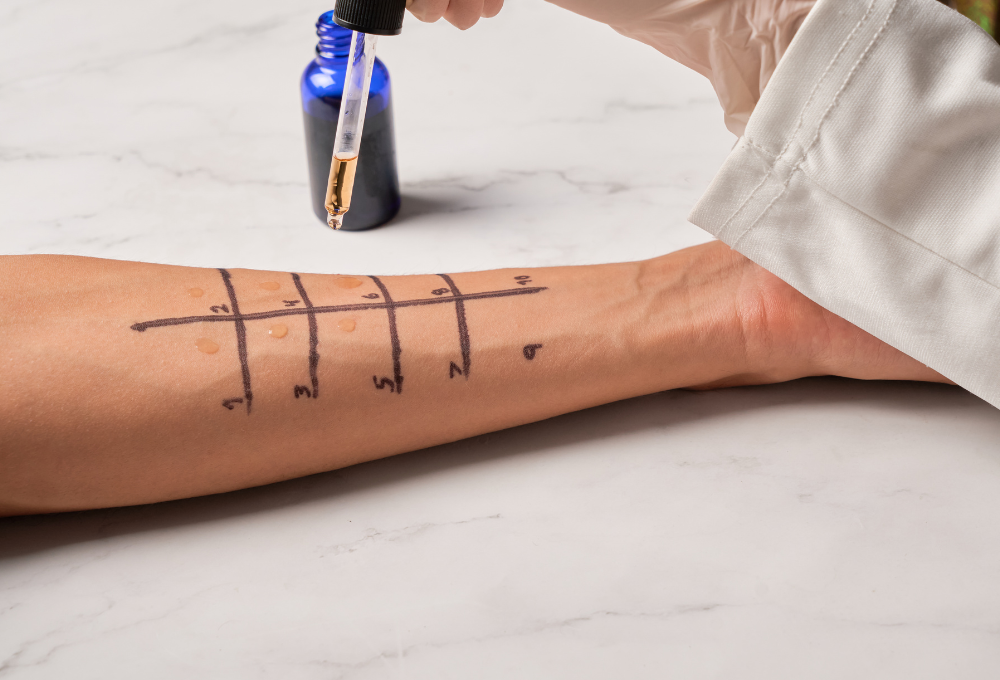 What Happens During an Allergy Test? A Step-by-Step Patient Guide